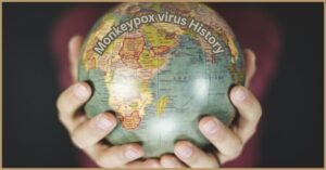 Monkeypox virus History